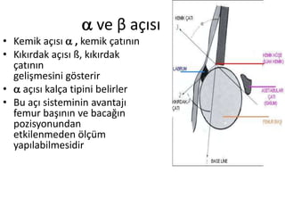  ve β açısı
• Kemik açısı  , kemik çatının
• Kıkırdak açısı ß, kıkırdak
  çatının
  gelişmesini gösterir
•  açısı kalça tipini belirler
• Bu açı sisteminin avantajı
  femur başının ve bacağın
  pozisyonundan
  etkilenmeden ölçüm
  yapılabilmesidir
 