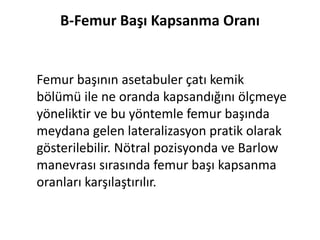 B-Femur Başı Kapsanma Oranı


Femur başının asetabuler çatı kemik
bölümü ile ne oranda kapsandığını ölçmeye
yöneliktir ve bu yöntemle femur başında
meydana gelen lateralizasyon pratik olarak
gösterilebilir. Nötral pozisyonda ve Barlow
manevrası sırasında femur başı kapsanma
oranları karşılaştırılır.
 