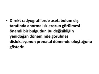 • Direkt radyografilerde asetabulum dış
  tarafında anormal sklerozun görülmesi
  önemli bir bulgudur. Bu değişikliğin
  yenidoğan döneminde görülmesi
  dislokasyonun prenatal dönemde oluştuğunu
  gösterir.
 