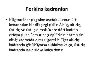 Perkins kadranları
• Hilgenreiner çizgisine asetabulumun üst
  kenarından bir dik çizgi çizilir. Alt-iç, alt-dış,
  üst-dış ve üst-iç olmak üzere dört kadran
  ortaya çıkar. Femur başı epifizinin normalde
  alt-iç kadranda olması gerekir. Eğer alt-dış
  kadranda gözüküyorsa sublukse kalça, üst-dış
  kadranda ise disloke kalça denir
 