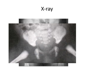 X-ray
 