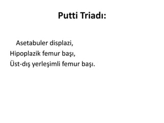 Putti Triadı:

  Asetabuler displazi,
Hipoplazik femur başı,
Üst-dış yerleşimli femur başı.
 