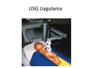 USG Uygulama
 