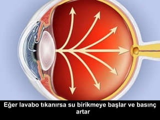 Eğer lavabo tıkanırsa su birikmeye başlar ve basınç artar 