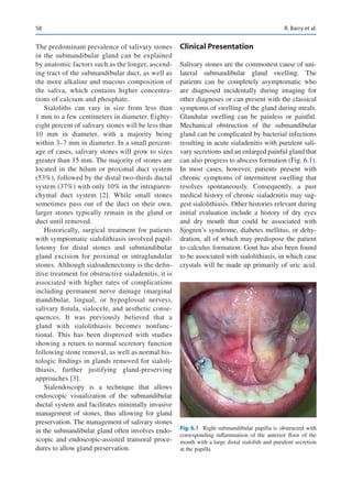 Thiasis Gland preserving salivary surgery | PDF