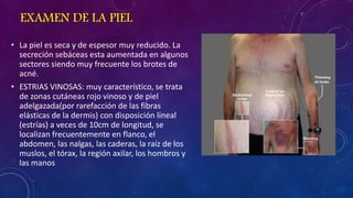 EXAMEN DE LA PIEL
• La piel es seca y de espesor muy reducido. La
secreción sebáceas esta aumentada en algunos
sectores siendo muy frecuente los brotes de
acné.
• ESTRIAS VINOSAS: muy característico, se trata
de zonas cutáneas rojo vinoso y de piel
adelgazada(por rarefacción de las fibras
elásticas de la dermis) con disposición lineal
(estrías) a veces de 10cm de longitud, se
localizan frecuentemente en flanco, el
abdomen, las nalgas, las caderas, la raíz de los
muslos, el tórax, la región axilar, los hombros y
las manos

 