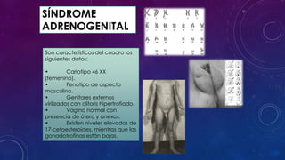 SÍNDROME
ADRENOGENITAL
Son característicos del cuadro los
siguientes datos:
•
Cariotipo 46 XX
(femenino).
•
Fenotipo de aspecto
masculino.
•
Genitales externos
virilizados con clítoris hipertrofiado.
•
Vagina normal con
presencia de útero y anexos.
•
Existen niveles elevados de
17-cetoesteroides, mientras que las
gonadotrofinas están bajas.

 