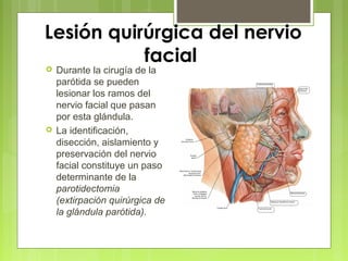 Lesión quirúrgica del nervio
facial
 Durante la cirugía de la
parótida se pueden
lesionar los ramos del
nervio facial que pasan
por esta glándula.
 La identificación,
disección, aislamiento y
preservación del nervio
facial constituye un paso
determinante de la
parotidectomia
(extirpación quirúrgica de
la glándula parótida).
 