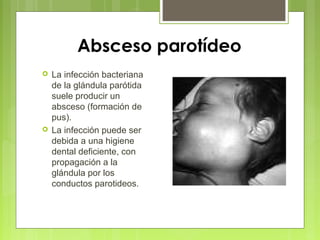 Absceso parotídeo
 La infección bacteriana
de la glándula parótida
suele producir un
absceso (formación de
pus).
 La infección puede ser
debida a una higiene
dental deficiente, con
propagación a la
glándula por los
conductos parotideos.
 