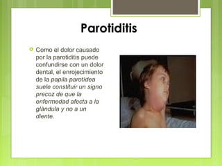 Parotiditis
 Como el dolor causado
por la parotiditis puede
confundirse con un dolor
dental, el enrojecimiento
de la papila parotídea
suele constituir un signo
precoz de que la
enfermedad afecta a la
glándula y no a un
diente.
 