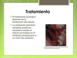 Tratamiento
 El tratamiento quirúrgico
depende de la
localización del calculo.
 La extirpación glandular
completa puede ser
necesaria cuando el
calculo se localiza en el
conducto principal pero a
un nivel mas posterior.
 