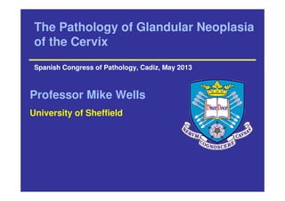 The Pathology of Glandular Neoplasia
of the Cervix
Spanish Congress of Pathology, Cadiz, May 2013
Professor Mike Wells
University of Sheffield
 