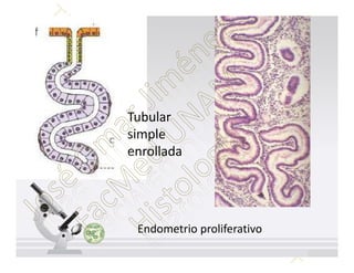 Tubular
simple
enrollada




 Endometrio proliferativo
 