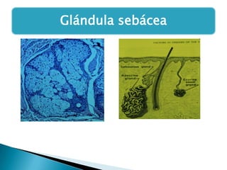 Glándula sebácea

 
