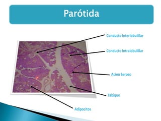 Parótida

 