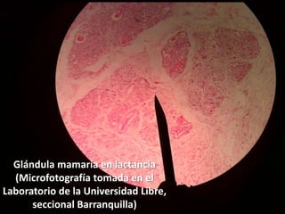 AguaElectrolitos (88%)Proteínas (1.3%) CaseínaCarbohidratos  (3.3%)  LactosaInmunoglobulinas (IgE e IgA)Con la edad, la glándula sufre una atrofia gradual de los acinos y las partes terminales del sistema ductal, y vuelve a su aspecto prepuberal. 