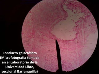 Conducto galactóforo (Microfotografía tomada en el Laboratorio de la Universidad Libre, seccional Barranquilla) 