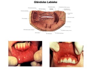 El ostium umbilical se localiza en el vértice de una papila situada a cada lado del frenillo lingual (carúnculas sublinguales). A. Frenillo lingual; C. Pliegue sublingual; B. Papilas sublinguales