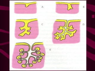 Glandulas salivales diana ruco