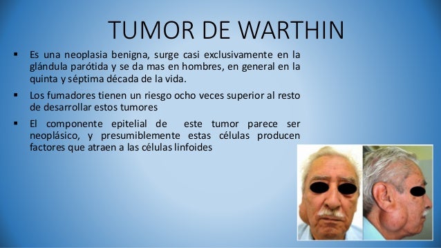 El Cancer En Ancianos Es Mas Lento