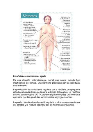 Insuficiencia suprarrenal aguda
Es una afección potencialmente mortal que ocurre cuando hay
insuficiencia de cortisol, una hormona producida por las glándulas
suprarrenales.
La producción de cortisol está regulada por la hipófisis, una pequeña
glándula ubicada detrás de la nariz y debajo del cerebro. La hipófisis
secreta corticotropina (ACTH, por sus siglas en inglés), una hormona
que hace que las glándulas suprarrenales segreguen cortisol.
La producción de adrenalina está regulada por los nervios que vienen
del cerebro y la médula espinal y por las hormonas circulantes.
 