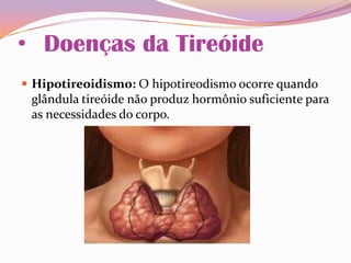 • Doenças da Tireóide
 Hipotireoidismo: O hipotireodismo ocorre quando
glândula tireóide não produz hormônio suficiente para
as necessidades do corpo.
 