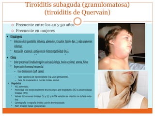 Tiroiditis subaguda (granulomatosa)
(tiroiditis de Quervain)
 Frecuente entre los 40 y 50 años
 Frecuente en mujeres
 