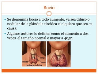 Bocio
 Se denomina bocio a todo aumento, ya sea difuso o
nodular de la glándula tiroidea cualquiera que sea su
causa.
 Algunos autores lo definen como el aumento a dos
veces el tamaño normal o mayor a 40gr.
 