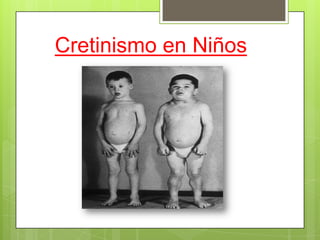 Cretinismo en Niños
 