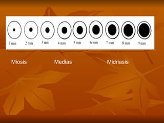 Miosis  Medias  Midriasis 