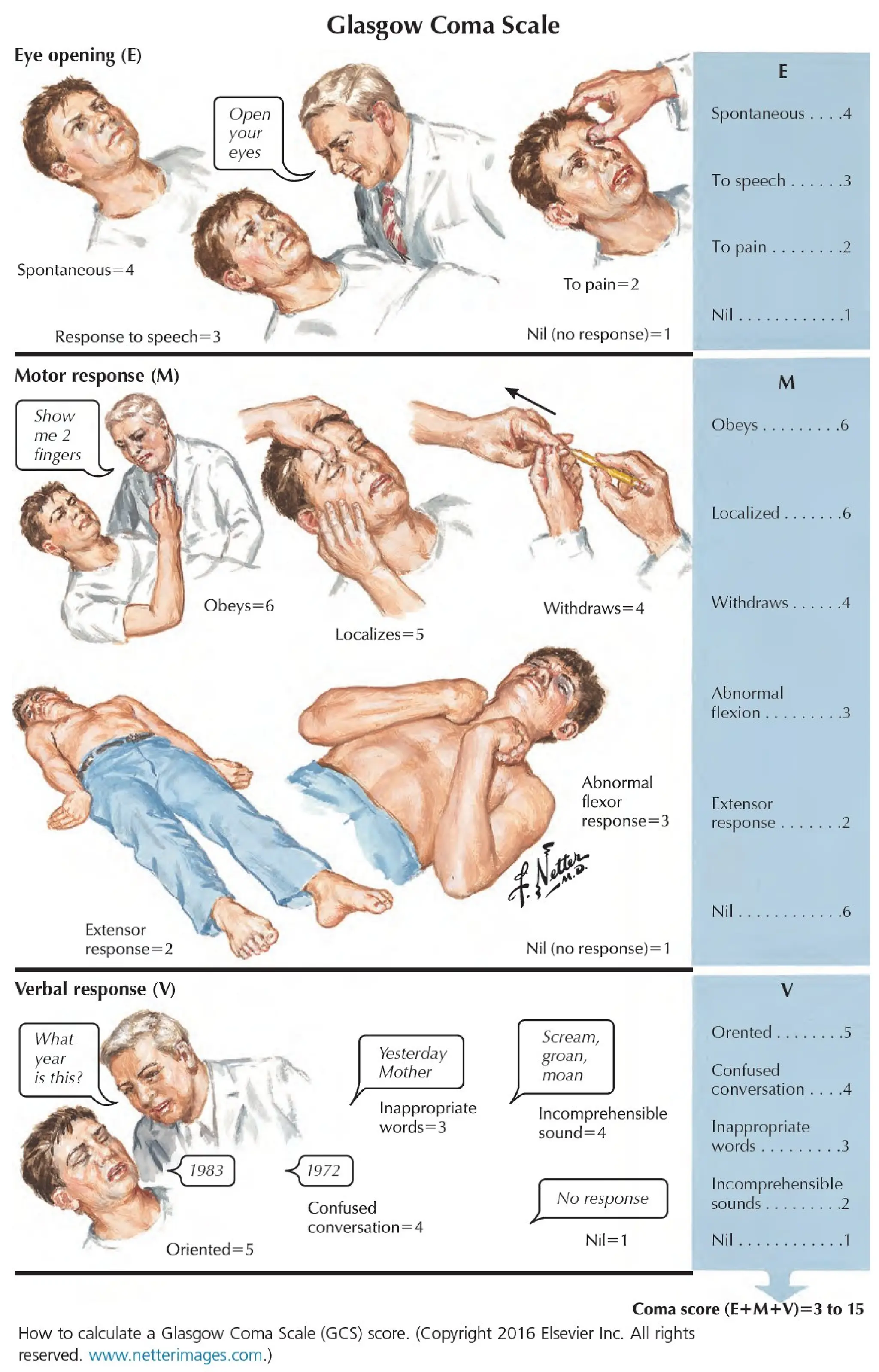 Glasgow Coma Scale Flow Chart Severity Of Head Injuries In Head Trauma 