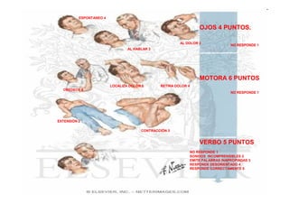 ESPONTANEO 4


                                                                    OJOS 4 PUNTOS.

                                                        AL DOLOR 2
                                                                                   NO RESPONDE 1
                                 AL HABLAR 3




                                                                    MOTORA 6 PUNTOS
                         LOCALIZA DOLOR 5      RETIRA DOLOR 4
  OBEDECE 6
                                                                                   NO RESPONDE 1




EXTENSIÓN 2

                                       CONTRACCIÓN 3


                                                                    VERBO 5 PUNTOS
                                                                NO RESPONDE 1
                                                                SONIDOS INCOMPRENSIBLES 2
                                                                EMITE PALABRAS INAPROPIADAS 3
                                                                RESPONDE DESORIENTADO 4
                                                                RESPONDE CORRECTAMENTE 5
 