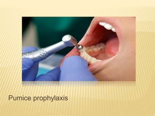 Pumice prophylaxis
 