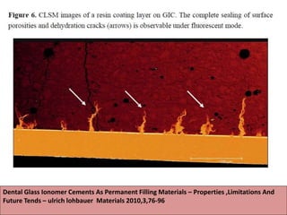 Dental Glass Ionomer Cements As Permanent Filling Materials – Properties ,Limitations And
Future Tends – ulrich lohbauer Materials 2010,3,76-96
 