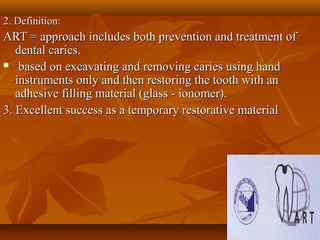 2. Definition:2. Definition:
ART = approach includes both prevention and treatment ofART = approach includes both prevention and treatment of
dental caries.dental caries.
 based on excavating and removing caries using handbased on excavating and removing caries using hand
instruments only and then restoring the tooth with aninstruments only and then restoring the tooth with an
adhesive filling material (glass - ionomer).adhesive filling material (glass - ionomer).
3. Excellent success as a temporary restorative material3. Excellent success as a temporary restorative material
 