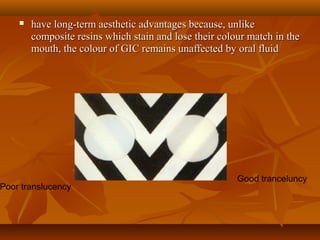  have long-term aesthetic advantages because, unlikehave long-term aesthetic advantages because, unlike
composite resins which stain and lose their colour match in thecomposite resins which stain and lose their colour match in the
mouth, the colour of GIC remains unaffected by oral fluidmouth, the colour of GIC remains unaffected by oral fluid
Poor translucency
Good tranceluncy
 