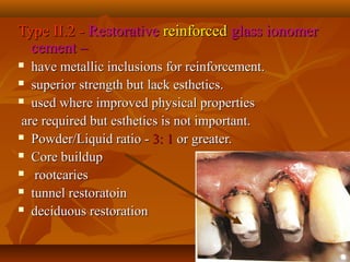 Type II.2 -Type II.2 - RestorativeRestorative reinforcedreinforced glass ionomerglass ionomer
cement –cement –
 have metallic inclusions for reinforcement.have metallic inclusions for reinforcement.
 superior strength but lack esthetics.superior strength but lack esthetics.
 used where improved physical propertiesused where improved physical properties
are required but esthetics is not important.are required but esthetics is not important.
 Powder/Liquid ratio -Powder/Liquid ratio - 3: 13: 1 or greater.or greater.
 Core buildupCore buildup
 rootcariesrootcaries
 tunnel restoratointunnel restoratoin
 deciduous restorationdeciduous restoration
 