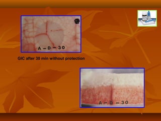 GIC after 30 min without protection
 