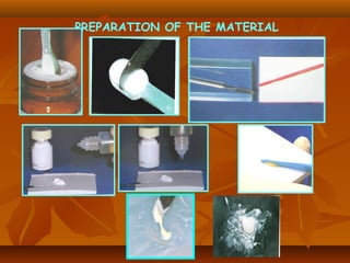 PREPARATION OF THE MATERIAL
 