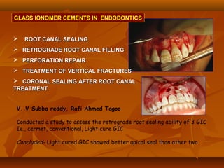  ROOT CANAL SEALINGROOT CANAL SEALING
 RETROGRADE ROOT CANAL FILLINGRETROGRADE ROOT CANAL FILLING
 PERFORATION REPAIRPERFORATION REPAIR
 TREATMENT OF VERTICAL FRACTURESTREATMENT OF VERTICAL FRACTURES
 CORONAL SEALING AFTER ROOT CANALCORONAL SEALING AFTER ROOT CANAL
TREATMENTTREATMENT
V. V Subba reddy, Rafi Ahmed Tagoo
Conducted a study to assess the retrograde root sealing ability of 3 GIC
Ie., cermet, conventional, Light cure GIC
Concluded- Light cured GIC showed better apical seal than other two
GLASS IONOMER CEMENTS IN ENDODONTICS
 