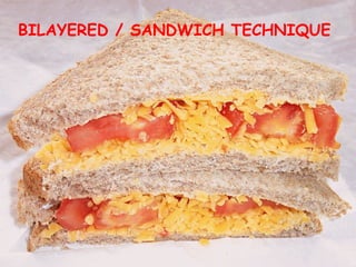 BILAYERED / SANDWICH TECHNIQUE
 