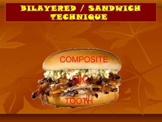 BILAYERED / SANDWICH
TECHNIQUE
COMPOSITE
TOOTH
GIC
 