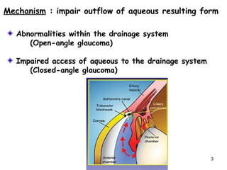 Glaucoma | PPT