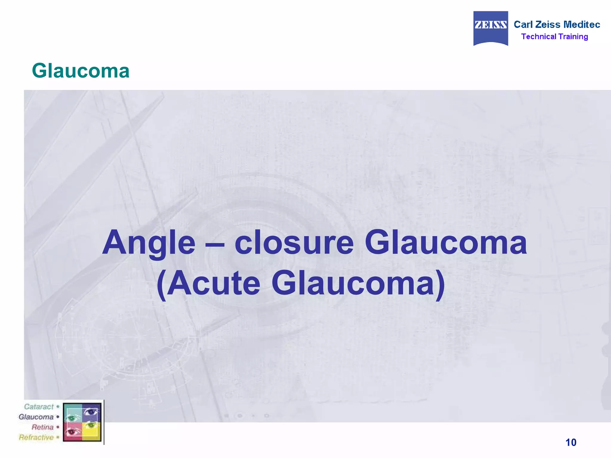 Glaucoma Angle – closure Glaucoma (Acute Glaucoma)  