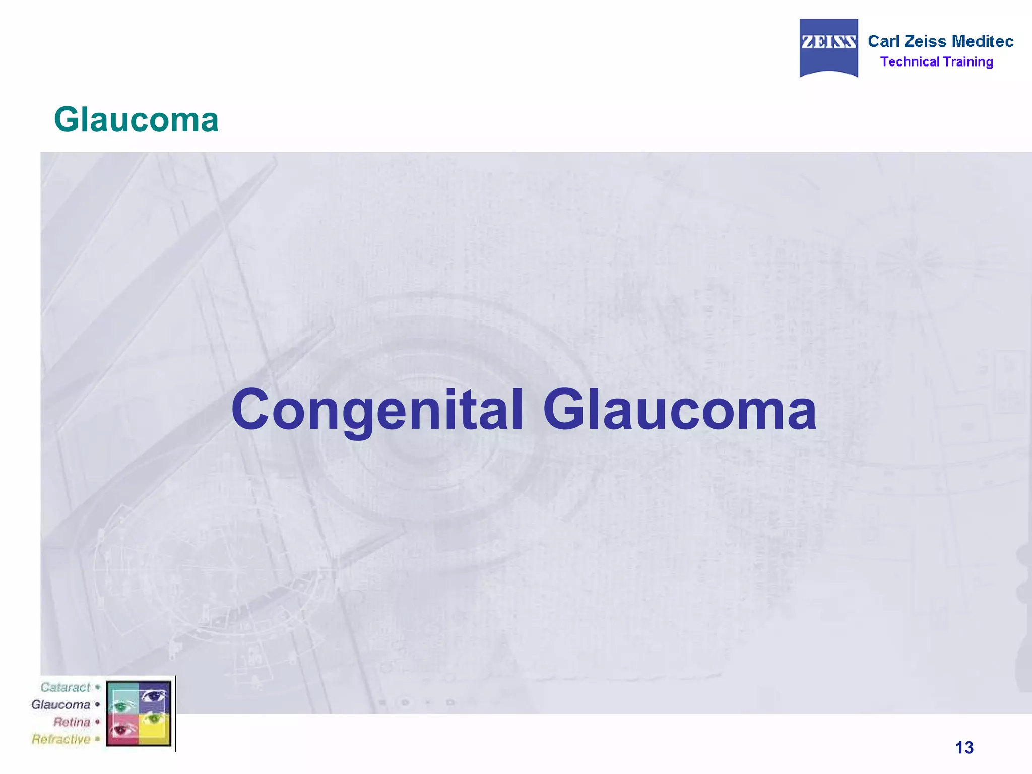 Glaucoma Congenital Glaucoma  