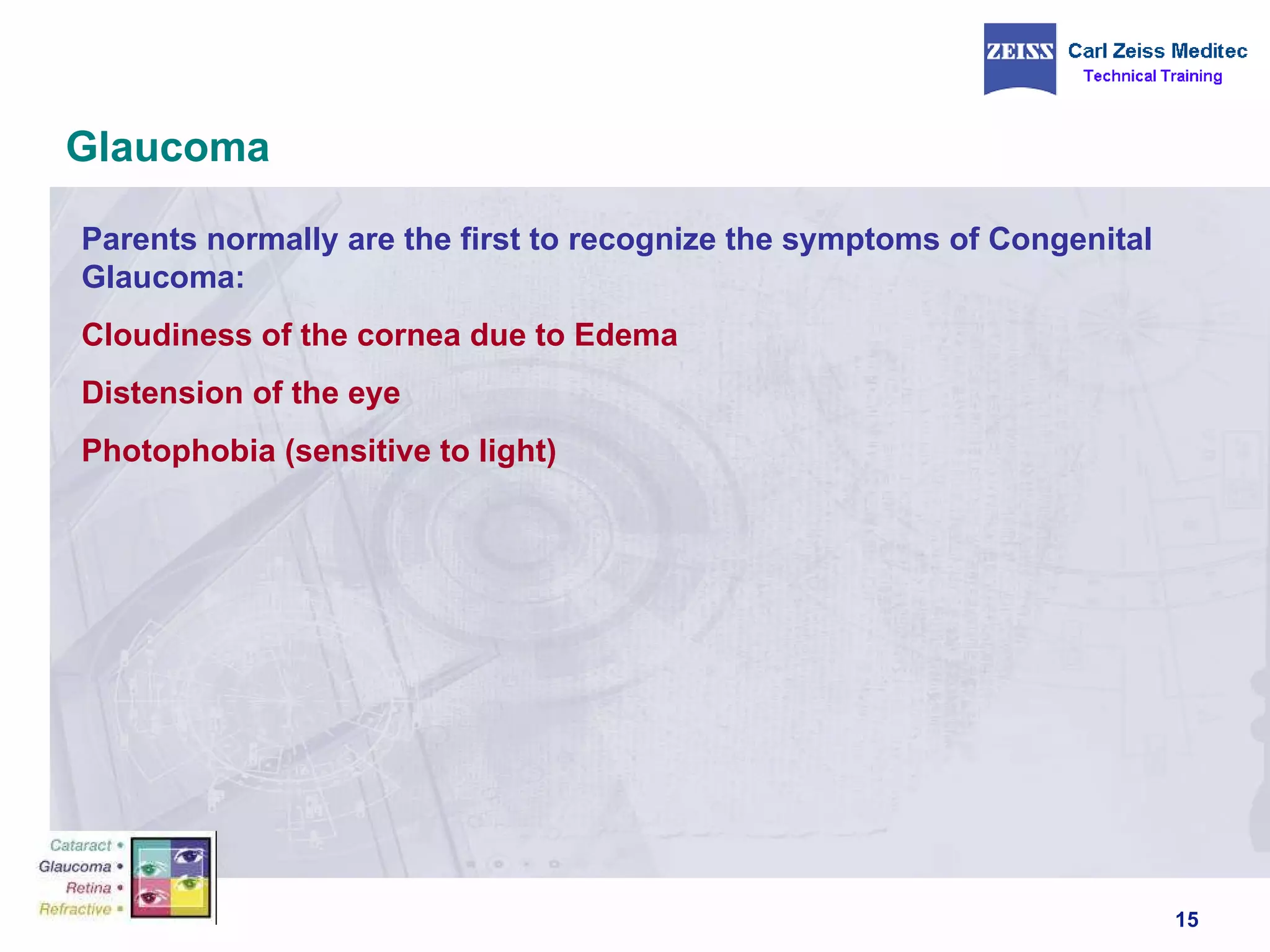 Glaucoma Parents normally are the first to recognize the symptoms of Congenital Glaucoma: Cloudiness of the cornea due to Edema Distension of the eye Photophobia (sensitive to light) 
