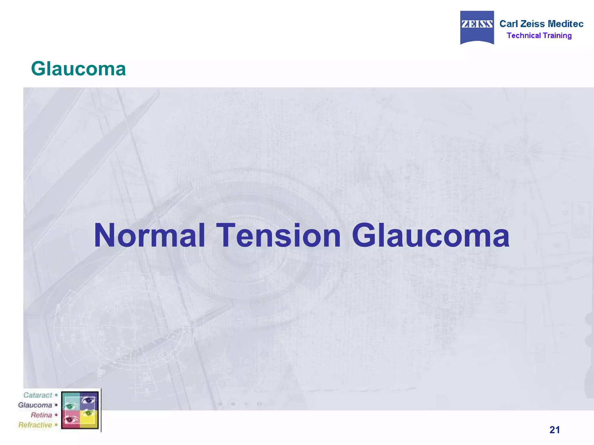 Glaucoma Normal Tension Glaucoma  