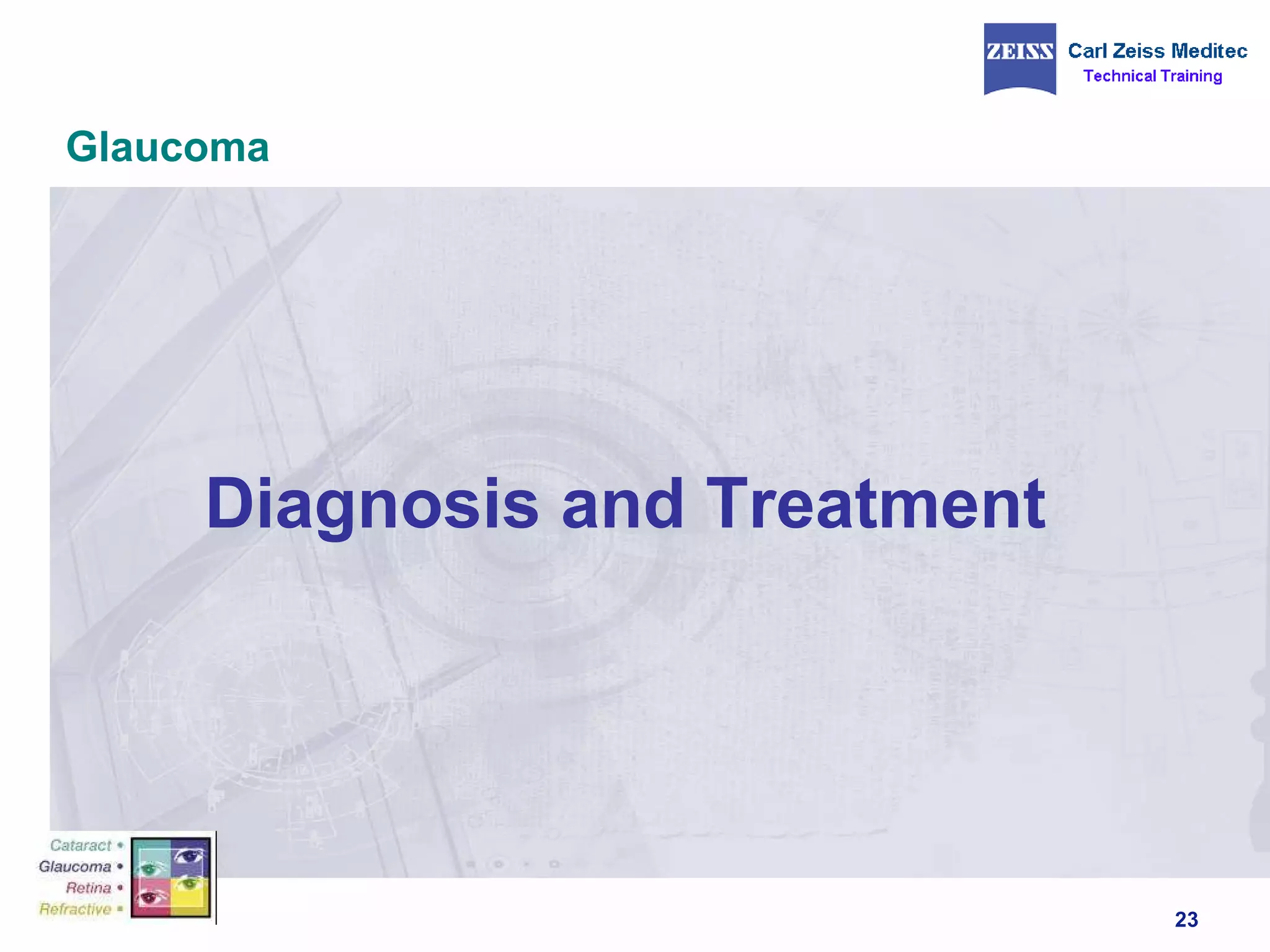 Glaucoma Diagnosis and Treatment  