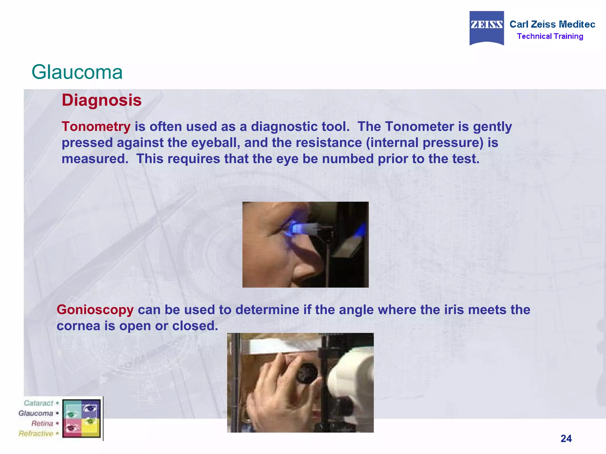 Diagnosis Tonometry  is often used as a diagnostic tool.  The Tonometer is gently pressed against the eyeball, and the resistance (internal pressure) is measured.  This requires that the eye be numbed prior to the test. Gonioscopy   can be used to determine if the angle where the iris meets the cornea is open or closed. Glaucoma 