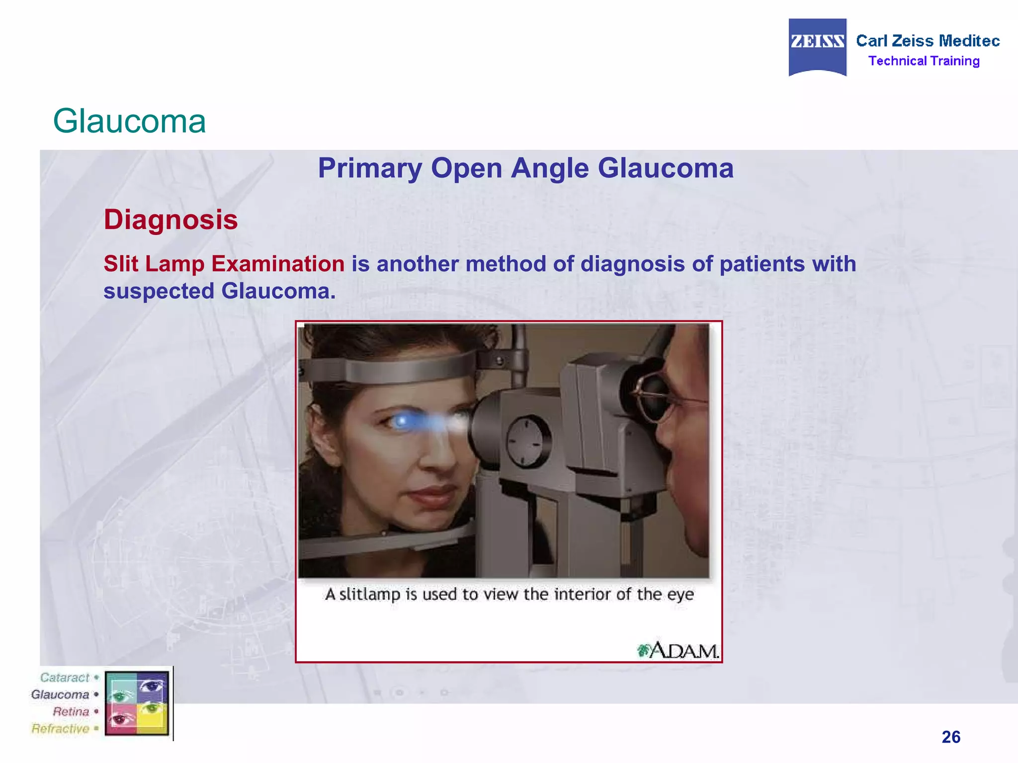 Primary Open Angle Glaucoma Diagnosis Slit Lamp Examination  is another method of diagnosis of patients with suspected Glaucoma. Glaucoma 